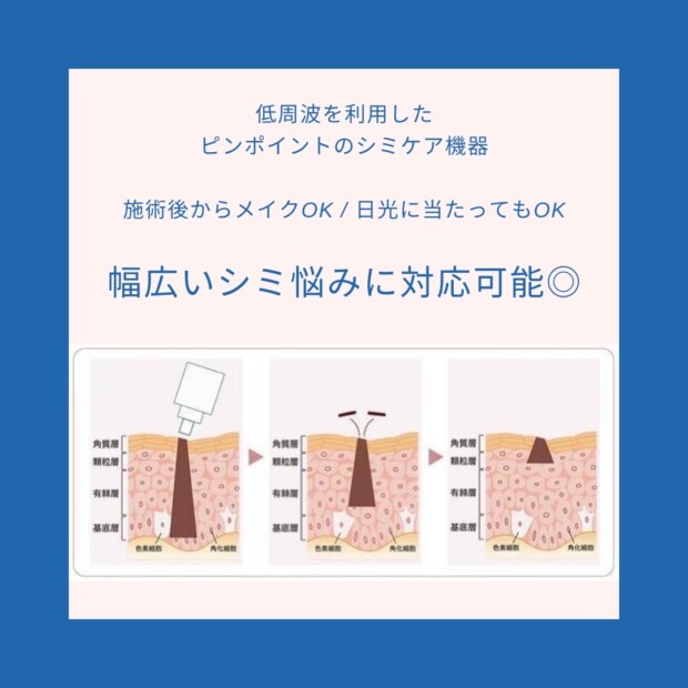 名古屋 シミ取り おすすめ