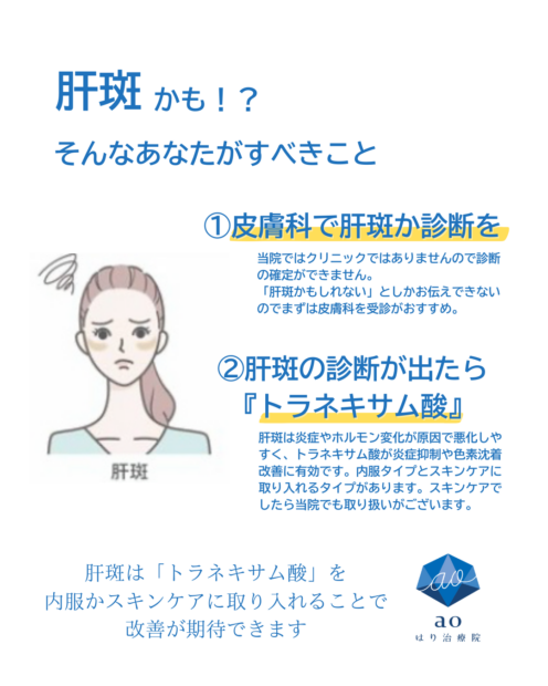 肝斑 名古屋