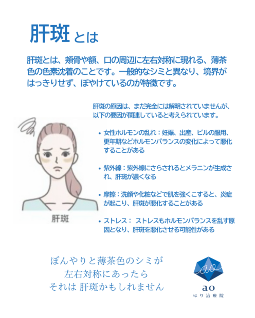 名古屋シミ取り 安い