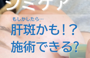肝斑 名古屋