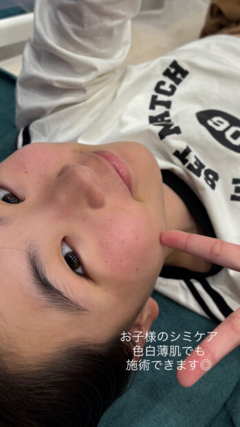 子供 そばかす 名古屋