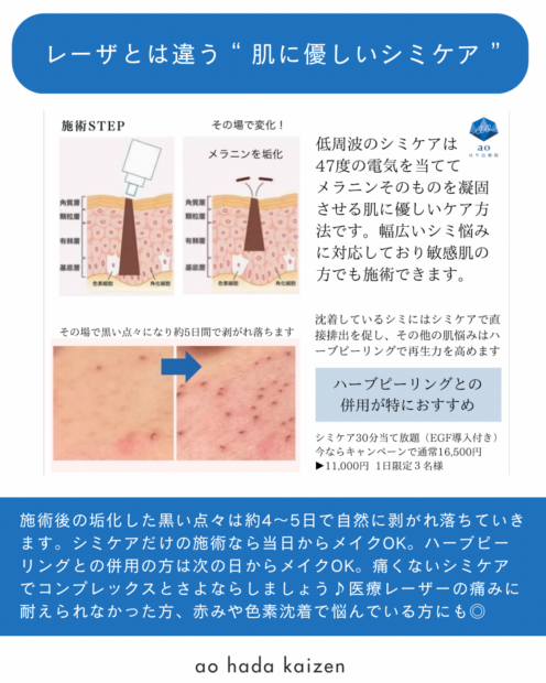 低周 シミ ペンシル 名古屋