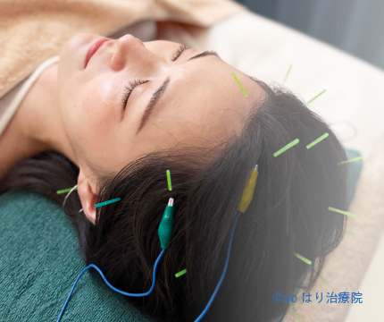 女性のための治療